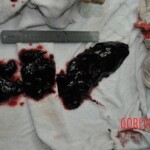Autopsy of stabbed girl