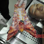 Autopsy of stabbed girl