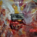 Autopsy of stabbed girl