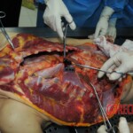 Autopsy of stabbed girl