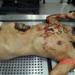 Autopsy of stabbed girl