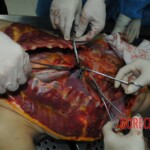 Autopsy of stabbed girl