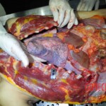 Autopsy of stabbed girl