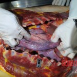 Autopsy of stabbed girl