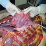 Autopsy of stabbed girl