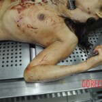 Autopsy of stabbed girl