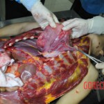 Autopsy of stabbed girl