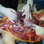 Autopsy of stabbed girl