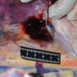 Autopsy of stabbed girl