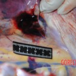 Autopsy of stabbed girl