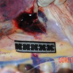 Autopsy of stabbed girl