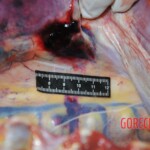 Autopsy of stabbed girl