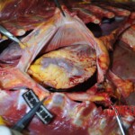 Autopsy of stabbed girl