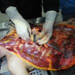 Autopsy of stabbed girl