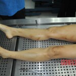 Autopsy of stabbed girl