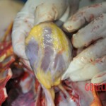 Autopsy of stabbed girl