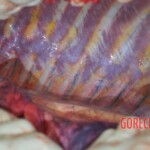 Autopsy of stabbed girl