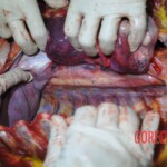 Autopsy of stabbed girl