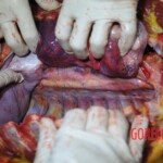 Autopsy of stabbed girl