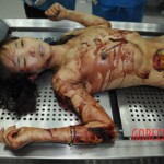 Autopsy of stabbed girl