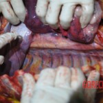 Autopsy of stabbed girl