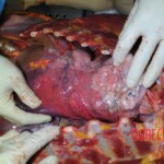 Autopsy of stabbed girl