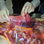 Autopsy of stabbed girl