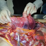 Autopsy of stabbed girl