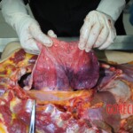 Autopsy of stabbed girl