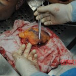 Autopsy of stabbed girl