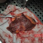 Autopsy of stabbed girl