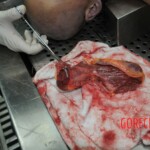 Autopsy of stabbed girl