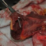 Autopsy of stabbed girl