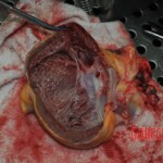 Autopsy of stabbed girl