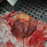 Autopsy of stabbed girl