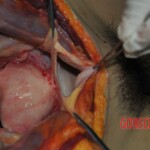 Autopsy of stabbed girl