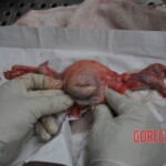 Autopsy of stabbed girl