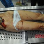 Autopsy of stabbed girl