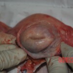 Autopsy of stabbed girl