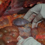 Autopsy of stabbed girl