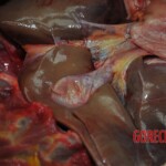 Autopsy of stabbed girl