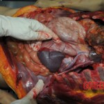 Autopsy of stabbed girl