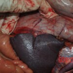 Autopsy of stabbed girl