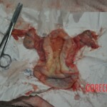 Autopsy of stabbed girl