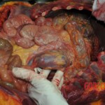 Autopsy of stabbed girl