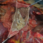 Autopsy of stabbed girl