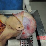 Autopsy of stabbed girl