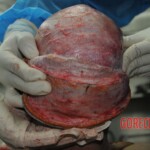 Autopsy of stabbed girl