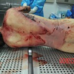 Autopsy of stabbed girl