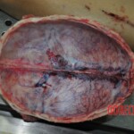 Autopsy of stabbed girl